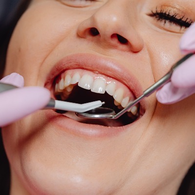 Demo Dental